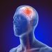 First Cardiology Consultant - stroke