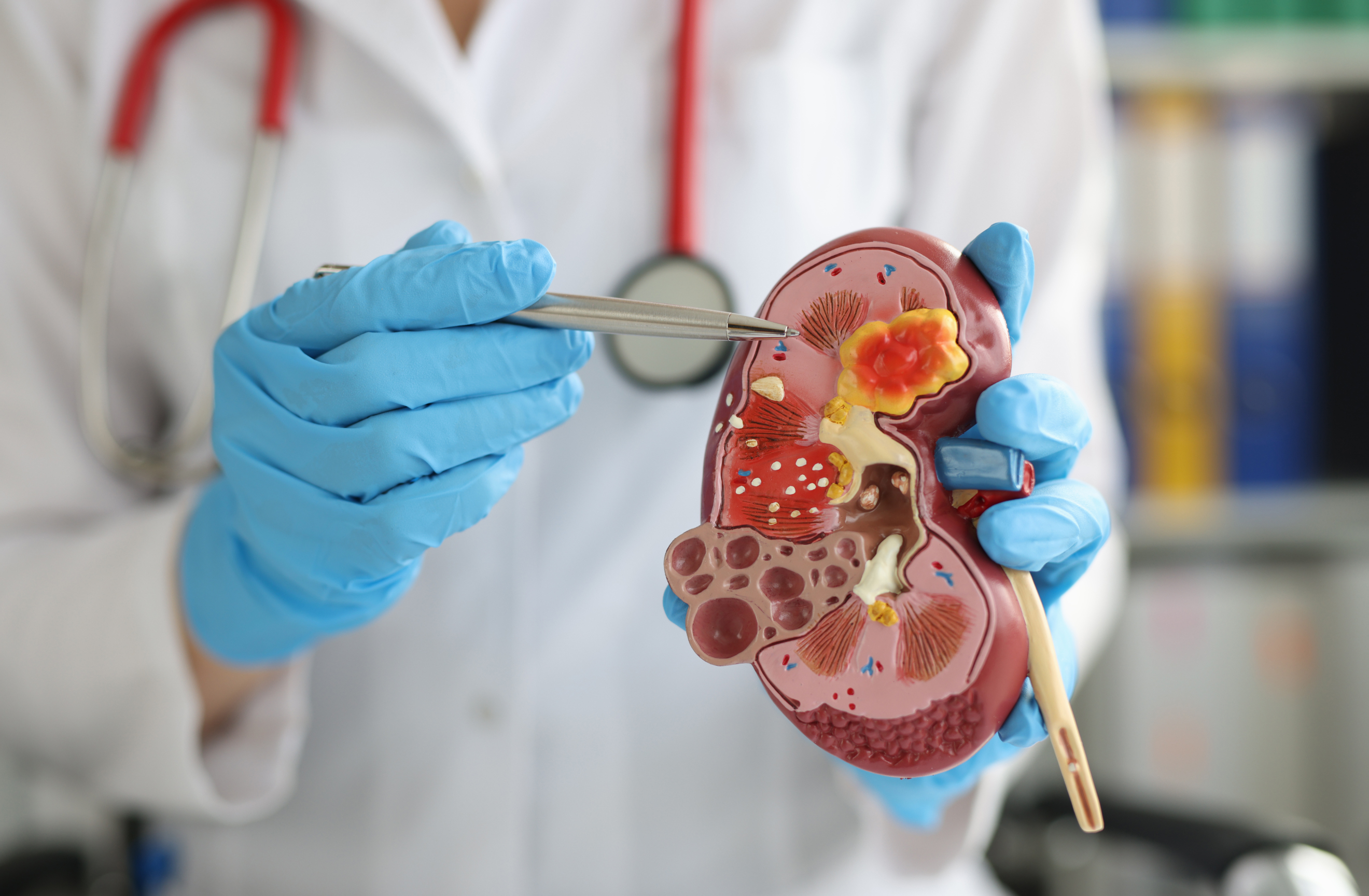 Celebrating World Kidney Day