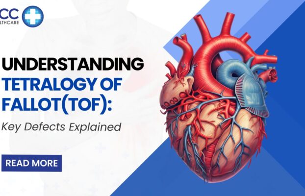 Understanding Tetralogy of Fallot: Key Defects Explained