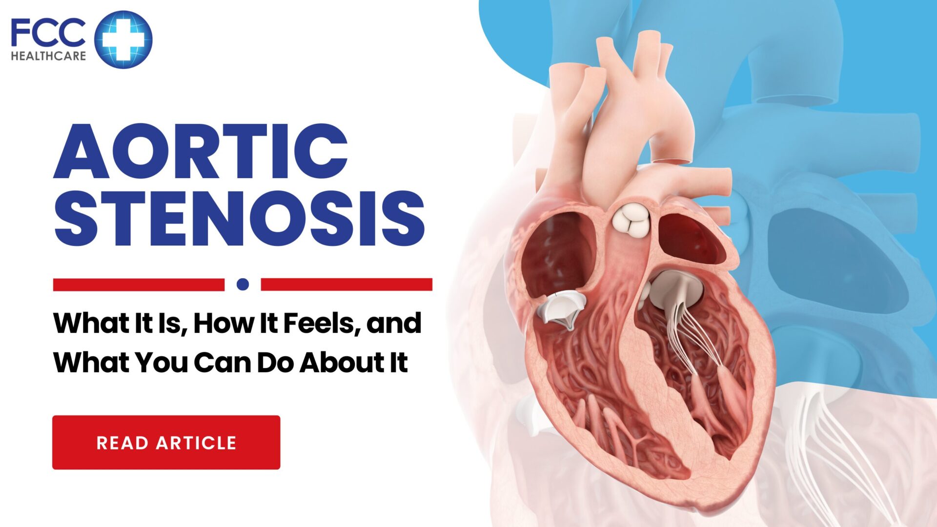 Aortic Stenosis: What It Is, How It Feels, and What You Can Do About It