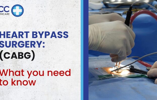 Heart Bypass Surgery: What you need to know