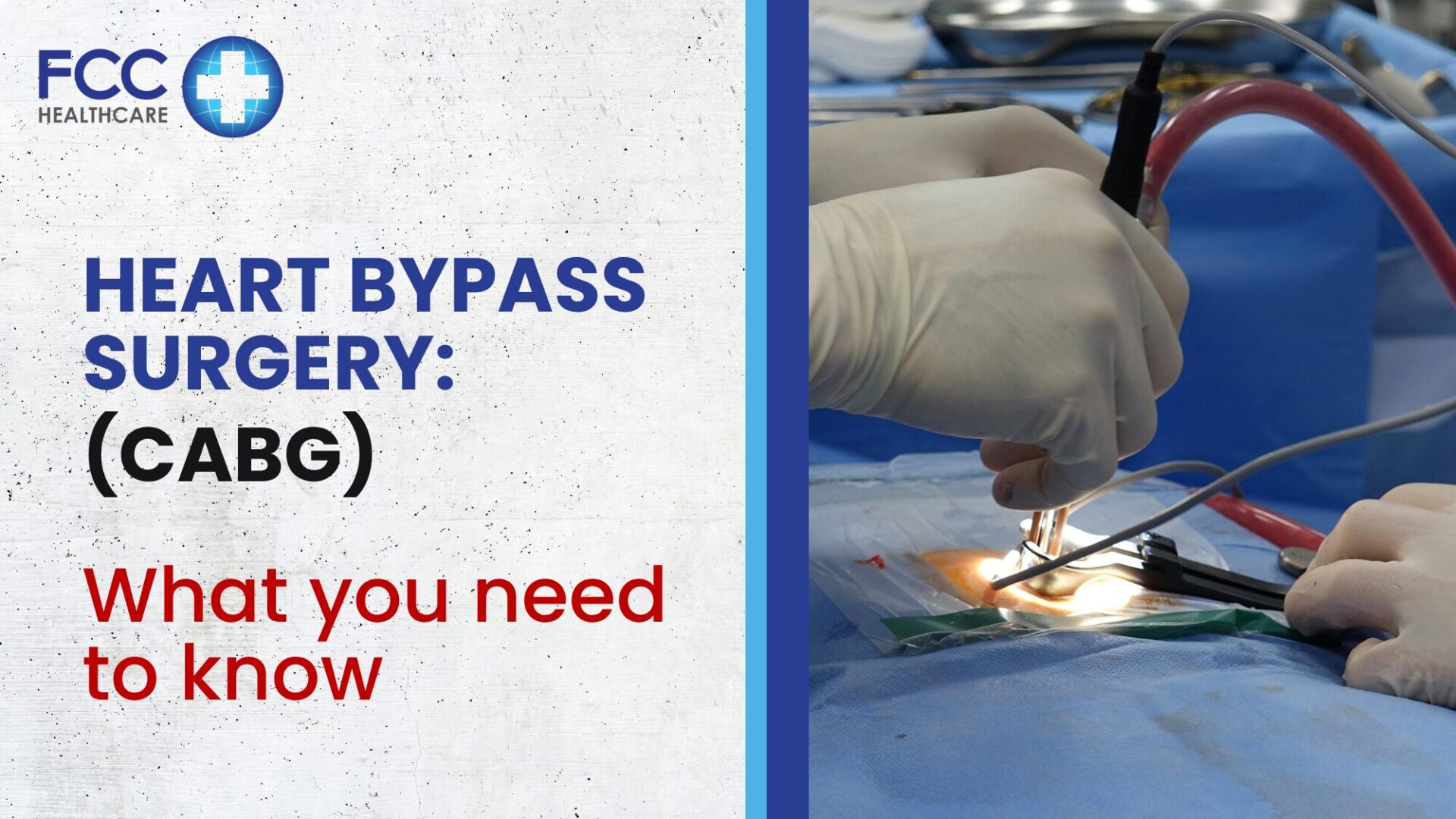 Heart Bypass Surgery: What you need to know